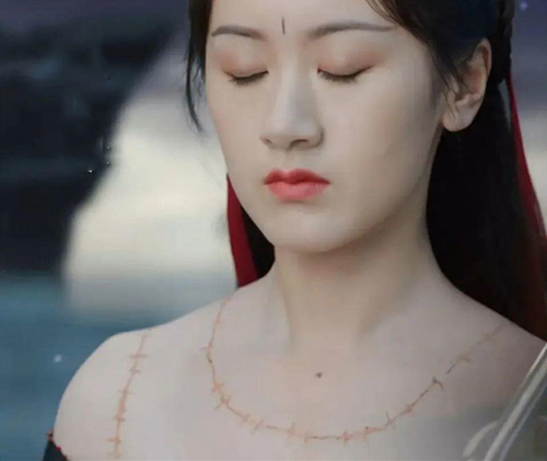 罗喉计都脖子有疤痕原因