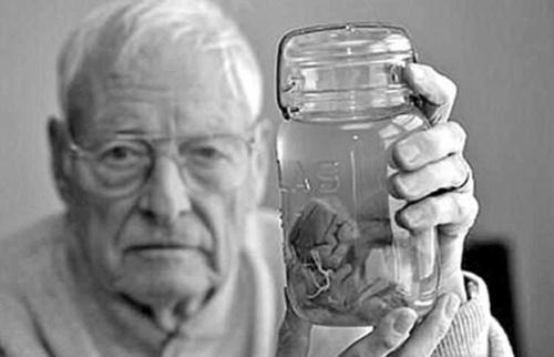 偷走爱因斯坦大脑的人